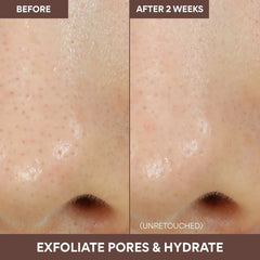 Volcanic Swirl Pore Mask